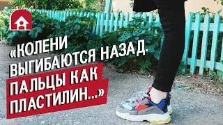 Девушка с синдромом Марфана: Ксюша | Быть Молодым