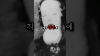 방사능까지 먹어야했던 미국노동자들      #미스터리 #방사능 #라듐