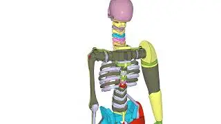 Impetus simulation of Biofidelic-Dummy (side impact)