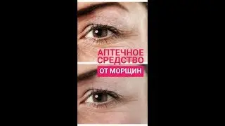 ОТ МОРЩИН - ЭТО есть в аптеке. Рецепт от морщин и отеков.