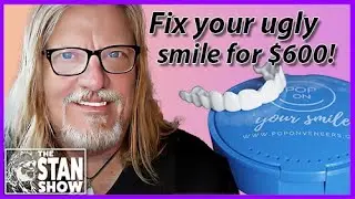 The Stan Show Episode #6 - What's the Deal With My Teeth • Pop On Veneers