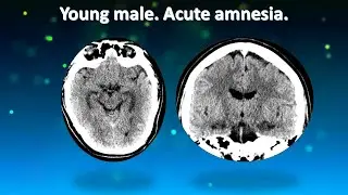 Young male. Acute amnesia.