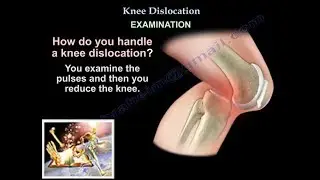 Knee Dislocation - Everything You Need To Know - Dr. Nabil Ebraheim