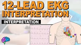 The SIMPLE Steps of 12-Lead EKG Interpretation - EXPLAINED CLEARLY!