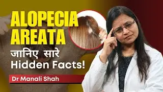 Alopecia Areata : जानिए सारे  Hidden Facts! | Dr Manali Shah | HairMD Pune