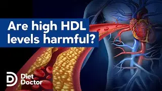 Are high HDL levels harmful?