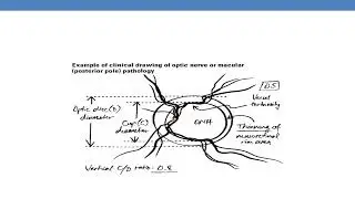 CPT CODING GUIDELINES FOR MEDICINE PART 7  Ophthalmology