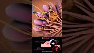 Breast Lump 💉 FNA ↹ Fine Needle Aspiration ⇢ Medical Arts Official