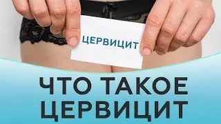 Что такое цервицит. Эндоцервицит и экзоцервицит