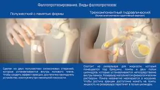Виды фаллопротезов. Техника установки, активации и дезактивации протеза полового члена