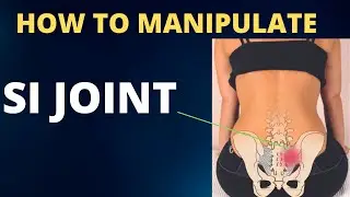 Manipulation of the Sacroiliac Joint (SIJ)