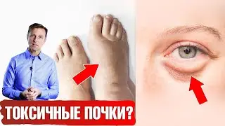 Болезни почек 👉 7 признаков. Лучшие и худшие продукты для почек