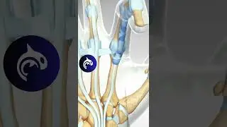 See how a Trigger Finger is released - 3D Animation 