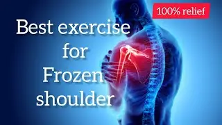 Yoga & exercise for shoulder lock। Exercise for frozen shoulder। কাঁধ এ ব্যাথার জন্য আসন ও ব্যায়াম