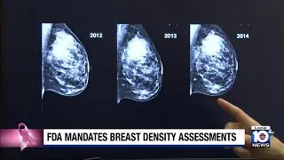 Changes now in effect to mammogram reports