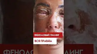 Феноловый пилинг. Вся правда о процедуре!