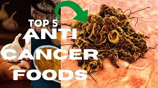 Cancer Dies When You Eat These 5 Foods! | Top 5 Anti Cancer Foods