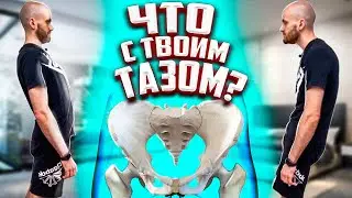 Про таз и позвоночник! Почему болит спина? От чего зависит осанка? Здоровая спина