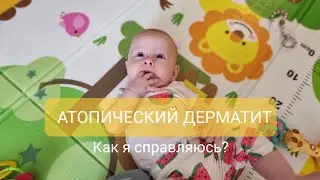 Атопический дерматит у ребенка. Как я справляюсь?