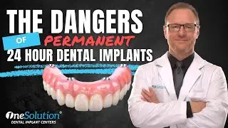 The Dangers of Getting Permanent Dental Implants in 24 hours!