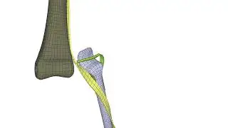 Impetus simulation of Biofidelic-Dummy (elbow joint destroyed)