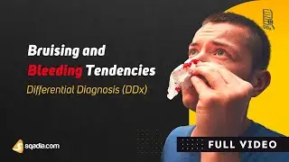 Bruising and Bleeding Tendencies | Differential Diagnosis (DDx) | Medicine Education