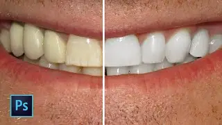 Best way to whiten teeth in adobe photoshop