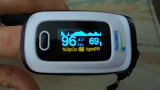 Pulse Oximeter with Atrial Fibrillation Display