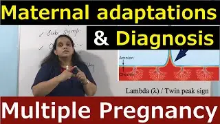 Maternal Adaptations & Diagnosis in Multiple Pregnancy | Nursing Lecture