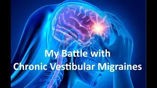 My Battle with Chronic Vestibular Migraines