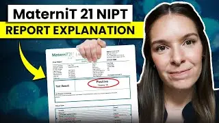 MaterniT 21 NIPT result explained