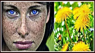 ОДУВАНЧИКИ от пигментных ПЯТЕН и веснушек на лице.