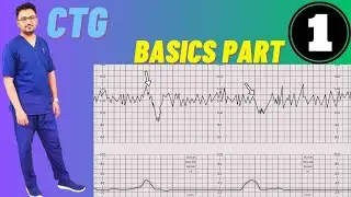 CTG Basics Part 1 | CTG Monitoring in Pregnancy| Fetal Cardiotocography