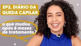 QUEDA DE CABELO: MEU TRATAMENTO PARA QUEDA CAPILAR EP.2 | JULIANA LOUISE