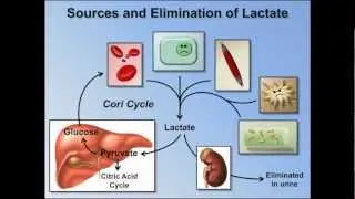 Elevated Anion Gap Metabolic Acidosis (ABG Interpretation - Lesson 8)