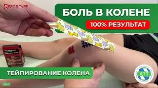 Боль в колене  Тейпирование колена  Триада тейпирования.