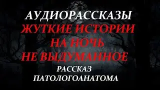 ЖУТКИЕ ИСТОРИИ НА НОЧЬ-РАССКАЗ ПАТОЛОГОАНАТОМА