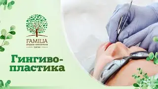 👉 Гингивопластика - в каких случаях проводится?