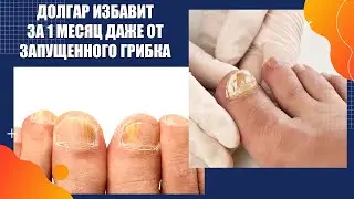 Бюджетные средства от грибка на ногах