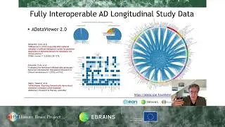 Martin Hofmann-Apitius - Ontologies for Clinical Neurosciences