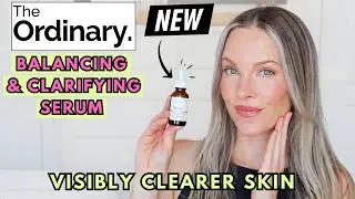 EXCLUSIVE: THE ORDINARY BALANCING & CLARIFYING SERUM REVIEW- TARGETS 7 SIGNS OF SKIN CONGESTION FAST