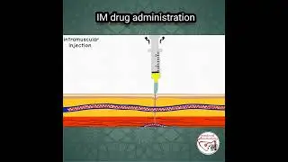 💉 INTRAMUSCULAR (IM) INJECTION, PROCEDURE | ANIMATED EXPLANATION