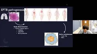 Extrapulmonary TB - Simmons 12-20-2021