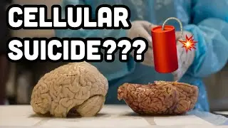 Can Brain Cells Commit SUICIDE??? Doctor Explains