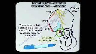 Sacroiliac Joint anatomy and its surrounding structures, a key to understanding low back pain