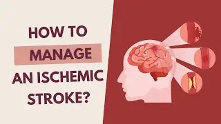 How to Manage an Ischemic Stroke?