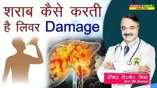 शराब कैसे करती है लिवर damage || VISUAL GUIDE TO LIVER PROBLEMS THE CAUSES