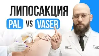 Всё про методы липосакции | PAL или VASER? | Какой метод липосакции лучше? | Пал или вэйзер?