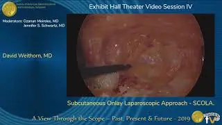 Subcutaneous Onlay Laparoscopic Approach - SCOLA