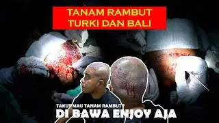 M3NGER1KAN HAIR TRANSPLANT !! BEAUTY IS PAIN | TANAM RAMBUT